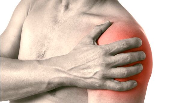 Otekla, rdeča in povečana rama - simptomi artroze ramenskega sklepa stopnje 2-3
