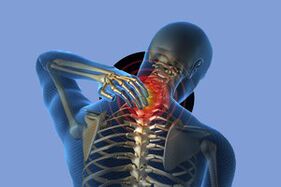 Simptomi osteohondroze materničnega vratu