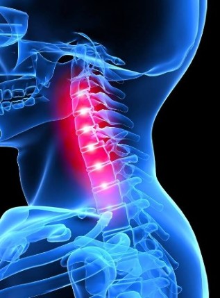 Osteochondrosis vratnih