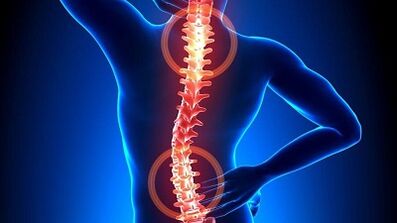 Mehanizem razvoja osteohondroze