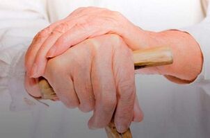 bolečine v sklepih prstov z revmatoidnim artritisom
