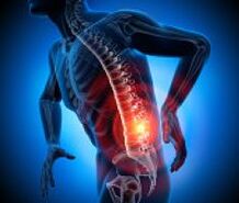 različni vzroki bolečin v hrbtu