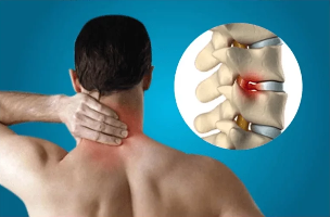 osteochondrosis od vratne hrbtenice